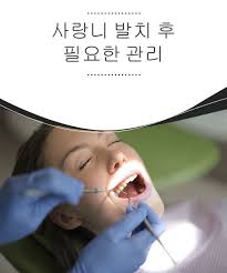 사랑니 발치 후 필요한 관리 건강을 위한 발걸음 2020 치료법 유방암 치아