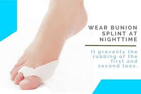 Pin On Bunion Remedies