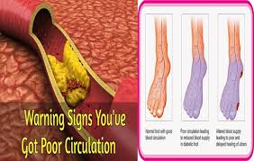Poor circulation in legs pictures. 6 Warning Symptoms That Tell You That You Have Poor Blood Circulation Inminutes Magazine