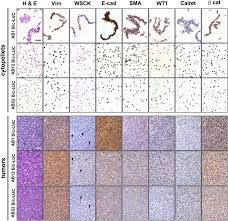 We did not find results for: Human Malignant Mesothelioma Is Recapitulated In Immunocompetent Balb C Mice Injected With Murine Ab Cells Scientific Reports