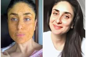 Testimonial pribadi beberapa telah diterbitkan membuktikan keberhasilan urotherapy. Rahasia Wajah Glowing Dan Awet Muda Kareena Kapoor Salah Satunya Dengan Pakai Masker Kunyit Begini Cara Buatnya Semua Halaman Nakita