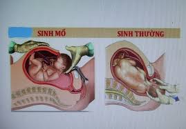Tuy nhiên, đại diện trung tâm kiểm soát bệnh tật tp.hcm (hcdc) vừa xác nhận thông tin nói trên không chính xác. Sá»©c Khá»e Sinh Sáº£n La Gi Va Má»™t Sá»' Khai Niá»‡m Chá»‰ Sá»' Cach Tinh Chá»‰ Sá»' Trong LÄ©nh Vá»±c Sá»©c Khá»e Sinh Sáº£n Kham Chá»¯a Bá»‡nh Phá»• Biáº¿n Kiáº¿n Thá»©c