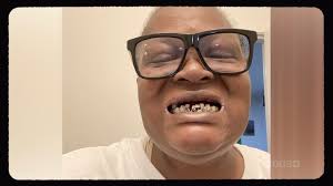 Woow!! 🤯 @dr.trevthomas has two more unique cases