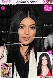 With the launch of kylie cosmetics, kylie jenner has gone from reality tv starlet to unbelievably successful entrepreneur in a matter of a few short years. Kylie Jenner Surgeries Kylie Jenner Plastic Surgery Kylie Jenner Surgery Celebrity Plastic Surgery