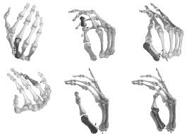 Hand Bones For Homework Anatomy Drawing Art Art Reference