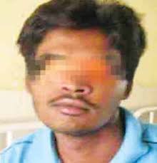 Monostotic Fibrous Dysplasia of Maxilla