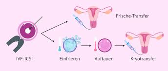 Frühere einnistungen verhindert die gebärmutterschleimhaut zuverlässig, während verspätete implantationen zwar möglich sind, aber zu einem großen teil zu fehlgeburten führen. Der Kryotransfer Wie Hoch Ist Die Erfolgsrate Bei Tiefgefrorenen Embryos