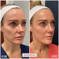 Aesthetician & Skincare Expert (@katrinaskincare) • Instagram photos and  videos