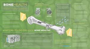 Calcium Calculator Infographic Bone Health Osteoporosis Osteoporosis Exercises