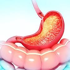 Was Ist Gastritis Behandlungen Diat Symptome Schmerzen Heilung Gastritis