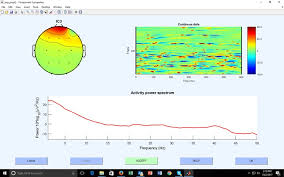 Check spelling or type a new query. Independent Components Analysis Ica A Perspective Brainmaster Technologies Inc