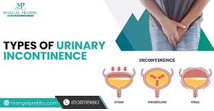 Image result for Urinary Incontinence