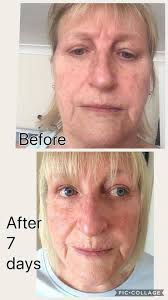 Maybe you would like to learn more about one of these? Trulum Skincare Fitness With Ulrika