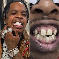 Finesse2Tymes explains why he didn't use to brush his teeth: "I Ain't Know  No Better, I Was Getting Money."