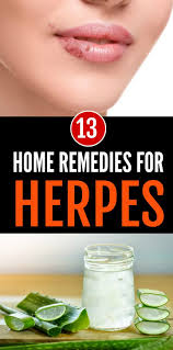 Pin On Natural Remedies