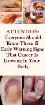 Early lung cancer symptoms also are relatively common in many other illnesses. Pin On Health