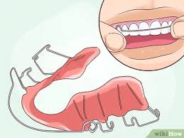 No fixed retainer will maintain them. How To Put On A Retainer 9 Steps With Pictures Wikihow