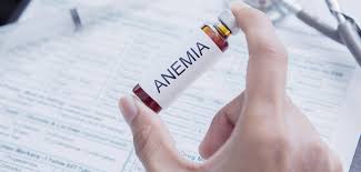 Tip:if you are viewing this electronically, in order to locate any word in the document, click failed or cancelled appouintment. Icd 10 Codes For Anemia Doccharge