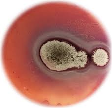 In addition to producing extracellular enzymes and citric acid, a. Characterization And Optimization Of Extracellular Enzymes Production By Aspergillus Niger Strains Isolated From Date By Products Journal Of Genetic Engineering And Biotechnology Full Text