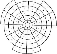 Radiotherapy In Thyroid Eye Disease The Effect On The Field Of Binocular Single Vision Journal Of American Association For Pediatric Ophthalmology And Strabismus Jaapos