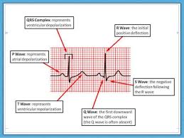 normal ecg interpretation