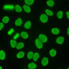 Image result for ANA Staining Pattern