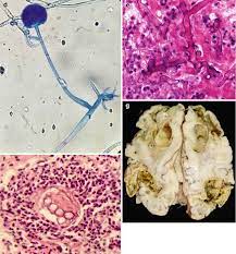 Community awareness research education support. Histopathology Springerlink