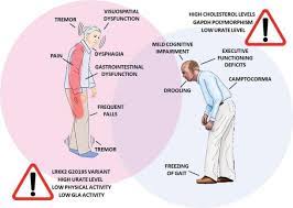 Search for parkinsons that are great for you! How And Why Does Parkinson S Disease Affect W Eurekalert