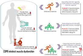 Image result for Exercise in COPD
