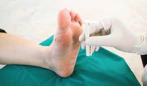 While high blood sugar levels and nerve damage or even wounds in the feet may result in foot ulcers in many cases. Racgp Diabetic Foot Ulcer