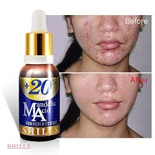 Junsui naturals facial wash is your ideal skin care solution to maintain your skin's natural look, junsui naturals contains absolute natural. Shills Nepal Posts Facebook