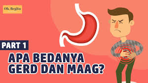 Para ahli meyakini bahwa faktor seperti genetik, biologis, lingkungan, psikologis, semuanya ini yang. Apa Bedanya Penyakit Gerd Dan Maag Dari Gejala Hingga Faktor Pemicunya Halaman All Kompas Com