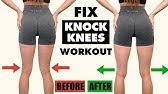 Save your knees and plantar fascia with this simple is this your first time here, in which you look for how to hide knock knees when walking? 5 Ways To Fix Knocked Knees Tight Inner Thighs Youtube