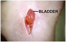 قام نيل فلاتو (في عام 1895) وكليمان ديوكس (في عام 1894) بوصف مرض الطفحية الذي اعتقدوا أنه شكل من أشكال الحصبة الألمانية، ولكن في عام 1900، وصفه ديوكس على أنها مرض منفصل الذي أصبح يعرف باسم مرض ديوكس. Pre Clinical Orthotopic Murine Model Of Human Prostate Cancer Protocol Translated To Arabic