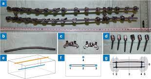 Airport metal detectors are quite sensitive to metals, this includes metal implants that may have been placed inside your body. Mri Following Scoliosis Surgery An Analysis Of Implant Heating Displacement Torque And Susceptibility Artifacts Springerlink