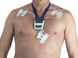 Dabei wird ein elektrokardiogramm über einen zeitraum von 24 stunden aufgezeichnet. Langzeit Ekg Behandlung Wirkung Risiken Medlexi De