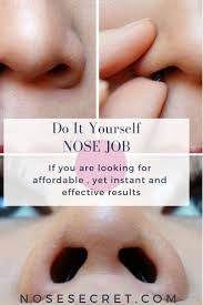Nosesecret Insert Adjust And See Instant Nose Job Results Visit Us At Nosesecret Com Differnce Nose Nosesecret Nosejob Nose Job Nose Reshaping Nose