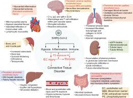 Image result for Connective Tissue Disorder