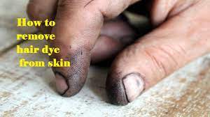 You have a few options when it comes to safely removing hair color stains from your face and neck. How To Remove Hair Dye From Skin à¤¸ à¤• à¤¨ à¤ªà¤° à¤²à¤— à¤¹ à¤¯à¤°à¤¡ à¤¯ à¤• à¤¨ à¤¶ à¤¨ à¤• à¤¸ à¤•à¤° à¤¸ à¤« Hair Dye Remover Youtube