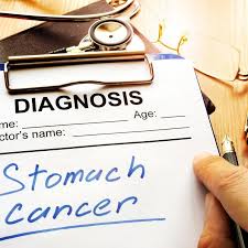 The signs or symptoms of stomach cancer include: Early Warning Signs Of Stomach Cancer Wear