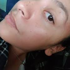 MARCEL F DANIELS, MD FACS FICS