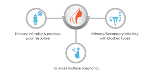 Natural Ivf Procedure And Treatment In Hyderabad India