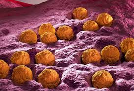 Image result for Rubella