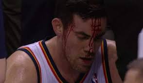 Nick Collison bloodied by Jeff Ayers elbow; needed four staples (GIF)