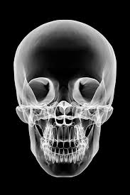 Image result for Skull XRay
