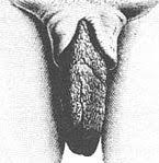 Wer ein schamlippenpiercing trägt, muss auch beim rasieren vorsichtig sein. Schamlippen Wikipedia