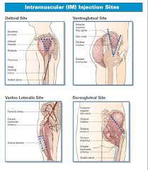 Im Injection Sites Not Supposed To Use Dorsoglut Anymore Due To Increased Risk Of Injury Ventroglut Is The Replacement Nurse Nursing Students Nursing Notes