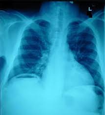 Pin On Health Personal Care Remedies And Ideas