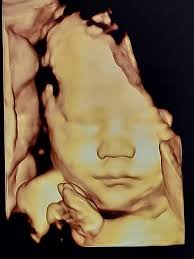 Mallory and Derrick hung