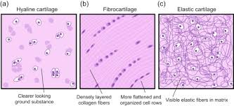 It is also most commonly found in the ribs, nose, larynx, and trachea. Scaffolds For Cartilage Tissue Engineering Sciencedirect